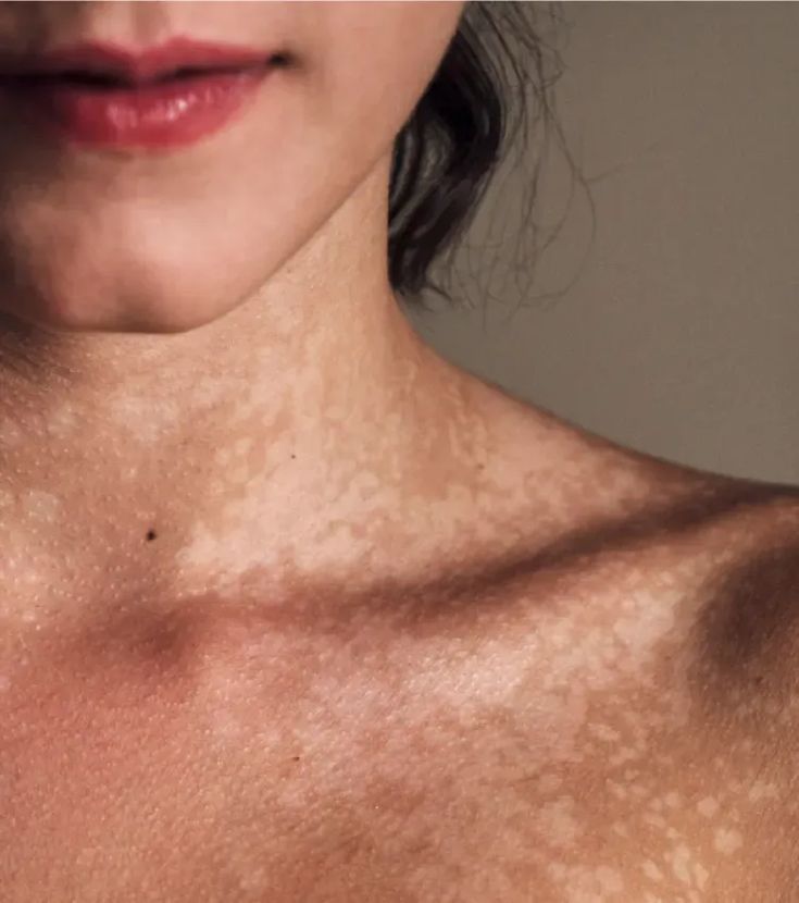 Routine anti-tâches blanches - Eclat & Uniformité